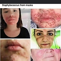 Staphylococcus from Masks
